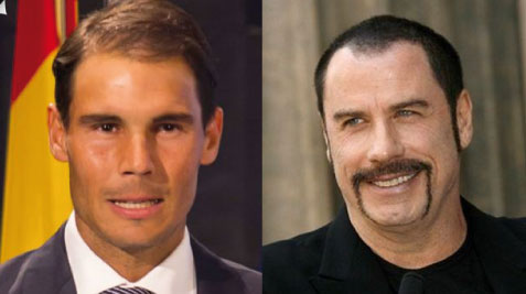 Trasplante capilar I Implantpel | Implantpel