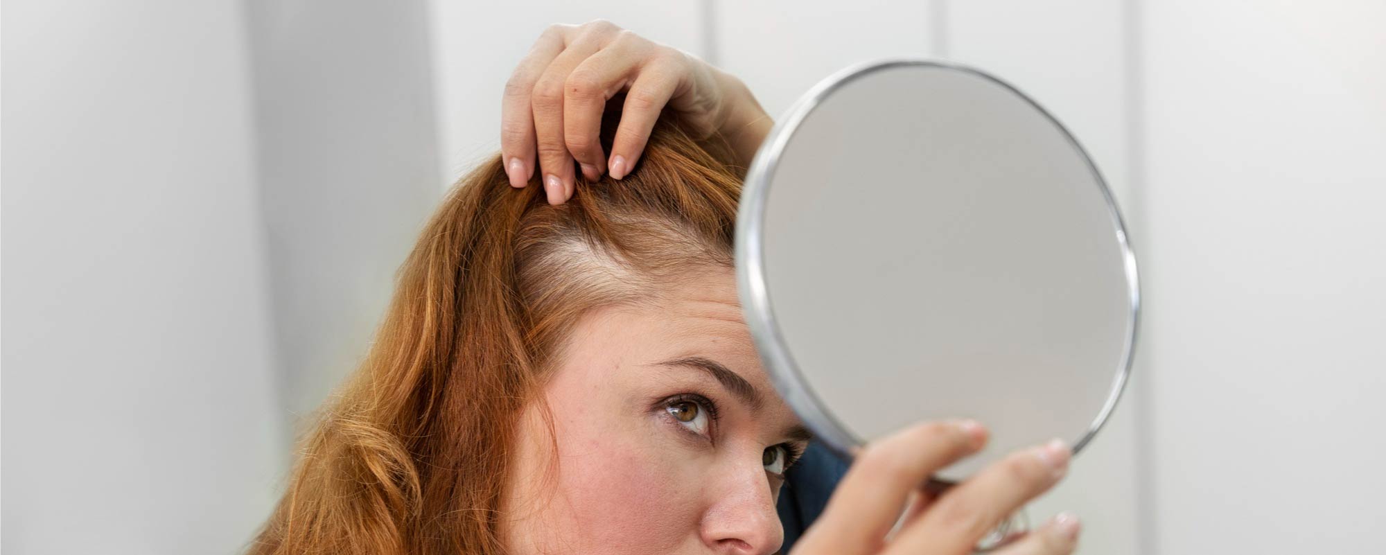 ¿Causas por las que se pierde Cabello? | Implantpel