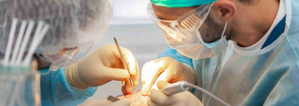 ¿Sabes cual es la técnica FUE? | Implantpel