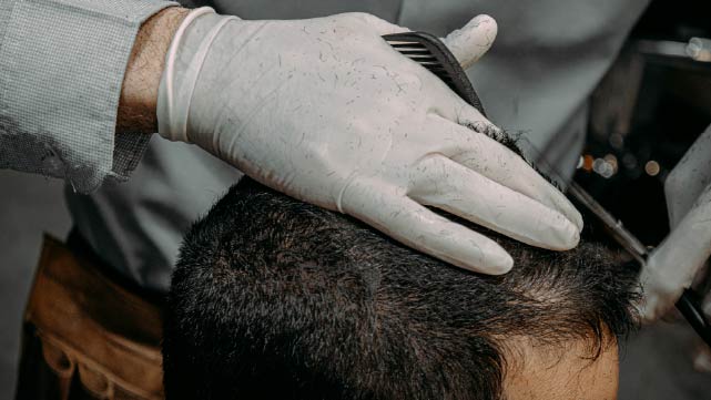 Los Resultados y la Evolución Tras un Injerto Capilar Masculino | Implantpel